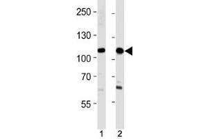 SALL4 antibody western blot analysis in 293,HeLa lysate.