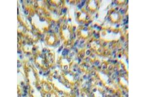 Used in DAB staining on fromalin fixed paraffin-embedded Kidney tissue (HSPD1 Antikörper  (AA 28-573))