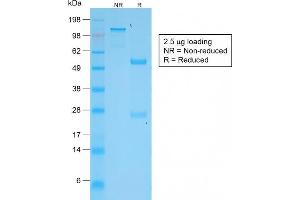 SDS-PAGE Analysis Purified VEGI Rabbit Monoclonal Antibody (VEGI /2052R). (Rekombinanter TNFSF15 Antikörper)