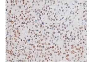 Immunohistochemistry (IHC) image for anti-LIM Domain Kinase 2 (LIMK2) (pSer283) antibody (ABIN6256239)