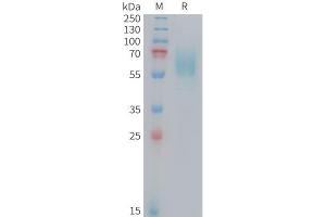 Mouse CD98 Protein, His Tag on SDS-PAGE under reducing condition.