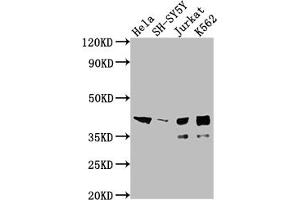 Western Blot Positive WB detected in: Hela whole cell lysate, SH-SY5Y whole cell lysate, Jurkat whole cell lysate, K562 whole cell lysate All lanes: ISL1 antibody at 1:2000 Secondary Goat polyclonal to rabbit IgG at 1/50000 dilution Predicted band size: 40 kDa Observed band size: 39 kDa (Rekombinanter ISL1 Antikörper)