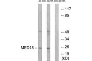 Western blot analysis of extracts from COLO/Jurkat cells, using MED18 Antibody. (MED18 Antikörper  (AA 70-119))
