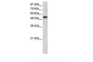 Image no. 1 for anti-Zinc Finger Protein 416 (ZNF416) (AA 90-139) antibody (ABIN202795) (ZNF416 Antikörper  (AA 90-139))