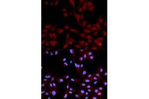 Immunofluorescence analysis of U2OS cell using Phospho-MAPK14-Y182-p antibody.