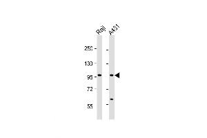 Western Blot at 1:1000 dilution Lane 1: Raji whole cell lysate Lane 2: A431 whole cell lysate Lysates/proteins at 20 ug per lane. (NFKB1 Antikörper  (AA 911-939))