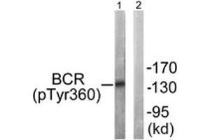 Western blot analysis of extracts from COS7 cells, using Bcr (Phospho-Tyr360) Antibody.