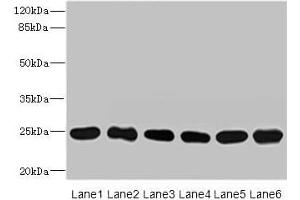 Western blot All lanes: FKBP14 antibody at 1 μg/mL Lane 1: Mouse stomach tissue Lane 2: Mouse gonadal tissue Lane 3: U937 whole cell lysate Lane 4: PC-3 whole cell lysate Lane 5: 293T whole cell lysate Lane 6: THP-1 whole cell lysate Secondary Goat polyclonal to rabbit IgG at 1/10000 dilution Predicted band size: 25 kDa Observed band size: 25 kDa (FKBP14 Antikörper  (AA 20-211))