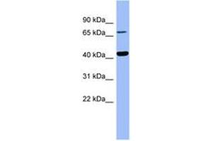 Image no. 1 for anti-4-Hydroxyphenylpyruvate Dioxygenase (HPD) (AA 179-228) antibody (ABIN6741738) (HPD Antikörper  (AA 179-228))
