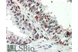 ABIN5539913 (5µg/ml) staining of paraffin embedded Human Prostate. (ZIC3 Antikörper  (AA 178-189))