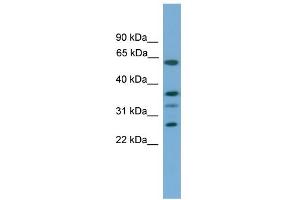 WB Suggested Anti-APOL2 Antibody Titration:  0. (Apolipoprotein L 2 Antikörper  (Middle Region))