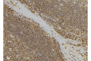 ABIN6279673 at 1/100 staining Human lymph node tissue by IHC-P. (PABPC3 Antikörper)