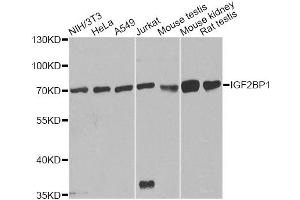 Western blot analysis of extracts of various cell lines, using IGF2BP1 antibody (ABIN5970711) at 1/1000 dilution. (IGF2BP1 Antikörper)