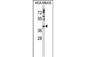 Western blot analysis in MDA-MB435 cell line lysates (35ug/lane). (DNAJC28 Antikörper  (C-Term))