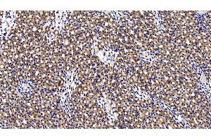 Immunohistochemistry (IHC) image for anti-Cathepsin S (CTSS) (AA 115-331) antibody (ABIN7441838)