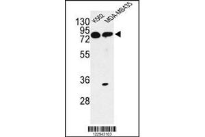 Western blot analysis of PRKAA1 Antibody in K562, MDA-MB435 cell line lysates (35ug/lane) (PRKAA1 Antikörper)