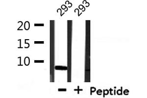 Western blot analysis of extracts from 293, using COX17 Antibody. (COX17 Antikörper  (N-Term))