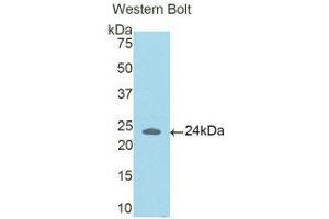 Western Blotting (WB) image for anti-Coiled-Coil Domain Containing 80 (CCD80) (AA 81-258) antibody (ABIN1176790) (CCDC80 Antikörper  (AA 81-258))