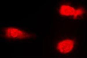 Immunofluorescent analysis of JNK1/2/3 (pT183) staining in NIH3T3 cells. (JNK Antikörper  (pSer183))