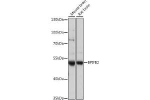 Western blot analysis of extracts of various cell lines, using BPIFB2 antibody (ABIN7265907) at 1:1000 dilution. (BPIL1 Antikörper  (AA 40-340))