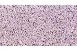 Paraformaldehyde-fixed, paraffin embedded Mouse liver, Antigen retrieval by boiling in sodium citrate buffer (pH6. (Complement Component C9b (C9b) (AA 251-350) Antikörper)