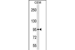 Western blot analysis in CEM cell line lysates (35ug/lane). (ADRBK2 Antikörper  (C-Term))