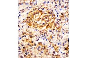 (ABIN652121 and ABIN2840556) staining ESRP1 in human pancreas tissue sections by Immunohistochemistry (IHC-P - paraformaldehyde-fixed, paraffin-embedded sections). (ESRP1 Antikörper  (AA 182-211))