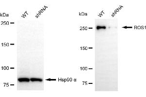 Western blotting analysis using ROS1 antibody (ABIN7797813).