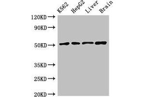 Western Blot Positive WB detected in: K562 whole cell lysate, HepG2 whole cell lysate, Rat liver tissue, Mouse brain tissue All lanes: RUVBL2 antibody at 2. (RUVBL2 Antikörper  (AA 281-444))