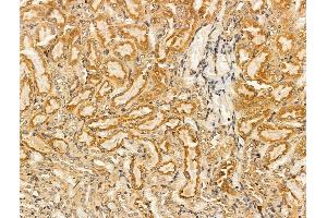 ABIN7094604 and ABIN7098654 at 1/100 staining Rat kidney tissue by IHC-P. (PLVAP Antikörper  (C-Term))