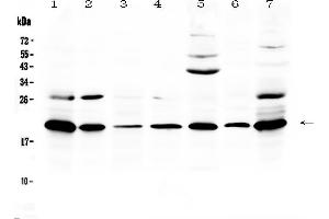 Western blot analysis of Ccl19/MIP-3 beta using anti-Ccl19/MIP-3 beta antibody . (CCL19 Antikörper  (AA 26-108))