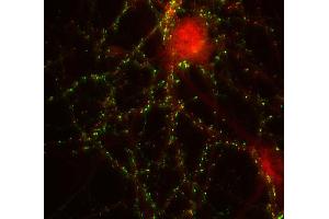 Indirect immunolabeling of PFA fixed rat hippocampus neurons with anti-shank 2 (dilution 1 : 500; red), counterstained with mouse anti-synapsin 1 (cat.