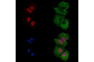ABIN6256915 and ABIN6274184 staining  cells by IF/ICC. (ATF7 Antikörper  (N-Term))