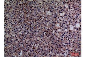 Immunohistochemistry (IHC) analysis of paraffin-embedded Human Liver, antibody was diluted at 1:100.