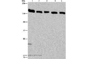 Western blot analysis of Hela cell and human testis tissue, A549, Jurkat and K562 cell, using IPO4 Polyclonal Antibody at dilution of 1:550 (Importin 4 Antikörper)