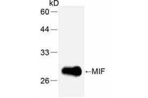 Western Blotting (WB) image for anti-Macrophage Migration Inhibitory Factor (Glycosylation-Inhibiting Factor) (MIF) (full length) antibody (ABIN1854219) (MIF Antikörper  (full length))