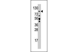 Western blot analysis of USP33 polyclonal antibody  in T-47D cell line lysate (35 ug/lane). (USP33 Antikörper  (C-Term))