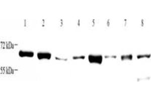 Western blot analysis of ZCCHC7 (ABIN7076279) at dilution of 1: 4000,Lane 1: HeLa cell lysate,Lane 2: K562 cell lysate,Lane 3: HL60 cell lysate,Lane 4: Mouse brain tissue lysate,Lane 5: Mouse kidney tissue lysate,Lane 6: Rat brain tissue lysate,Lane 7: Rat kidney tissue lysate,Lane 8: Rat uterus tissue lysate (ZCCHC7 Antikörper)