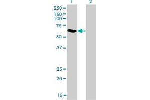 Western Blot analysis of RBM5 expression in transfected 293T cell line by RBM5 monoclonal antibody (M01), clone 2B6. (RBM5 Antikörper  (AA 75-184))