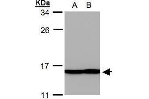 WB Image Sample(30 ug whole cell lysate) A: A431, B: H1299 12% SDS PAGE antibody diluted at 1:500 (PFN2 Antikörper)