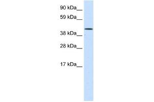 WB Suggested Anti-SMARCA1 Antibody Titration:  1. (SMARCA1 Antikörper  (N-Term))
