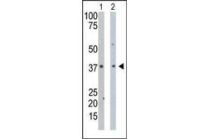 The anti-PDXK Pab is used in Western blot to detect PDXK in mouse intestine tissue lysate (Lane 1) and Hela cell lysate (Lane 2). (PDXK Antikörper  (N-Term))