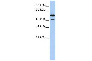 DNASE2B antibody used at 1 ug/ml to detect target protein. (DNASE2B Antikörper  (Middle Region))