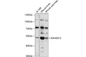 Western blot analysis of extracts of various cell lines, using KI antibody (ABIN7268113) at 1:1000 dilution. (KIAA0513 Antikörper  (AA 1-301))
