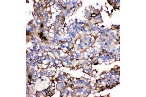 IHC analysis of GLUT9 using anti-GLUT9 antibody (ABIN3044546).