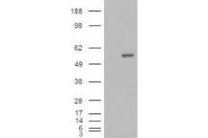 Image no. 2 for anti-Aldehyde Dehydrogenase 1 Family, Member A1 (ALDH1A1) (C-Term) antibody (ABIN374078) (ALDH1A1 Antikörper  (C-Term))