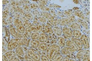 ABIN6272992 at 1/100 staining Mouse kidney tissue by IHC-P. (CLTA Antikörper)