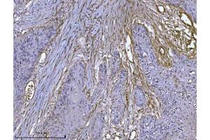 IHC analysis of Integrin linked ILK using anti-Integrin linked ILK antibody (ABIN7599410). (ILK Antikörper  (AA 1-452))
