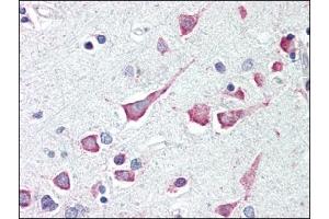 Image no. 1 for anti-Death-Associated Protein Kinase 3 (DAPK3) (Center) antibody (ABIN303252) (DAPK3 Antikörper  (Center))