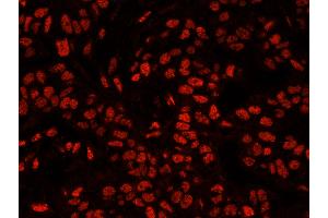 Immunofluorescence (IF) image for anti-5'-3' Exoribonuclease 2 (XRN2) (AA 900-950) antibody (ABIN7449038) (XRN2 Antikörper  (AA 900-950))